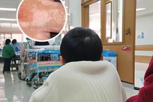 白駁風(fēng)的病因病機(jī)有哪些組成